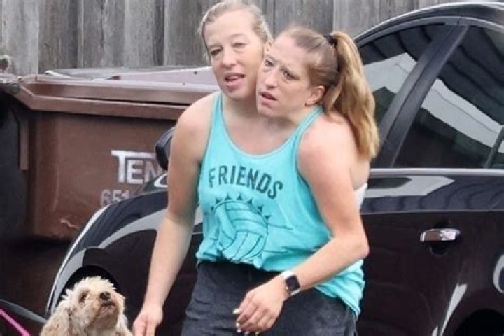 Unfolding The Story Of Abby And Brittany Hensel: Sad News That Shook Their Fans